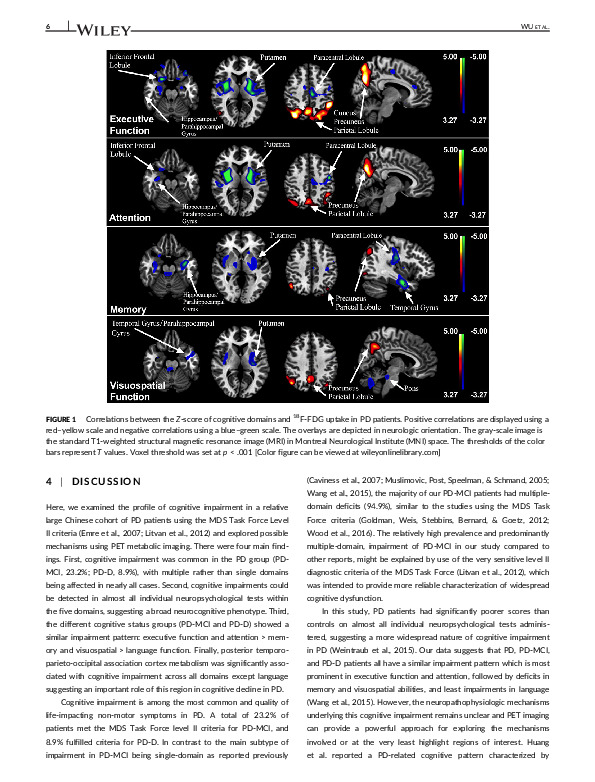 Download Clinical characteristics of cognitive impairment in patients with Parkinson's disease and its related pattern in 18F‐FDG PET imaging.