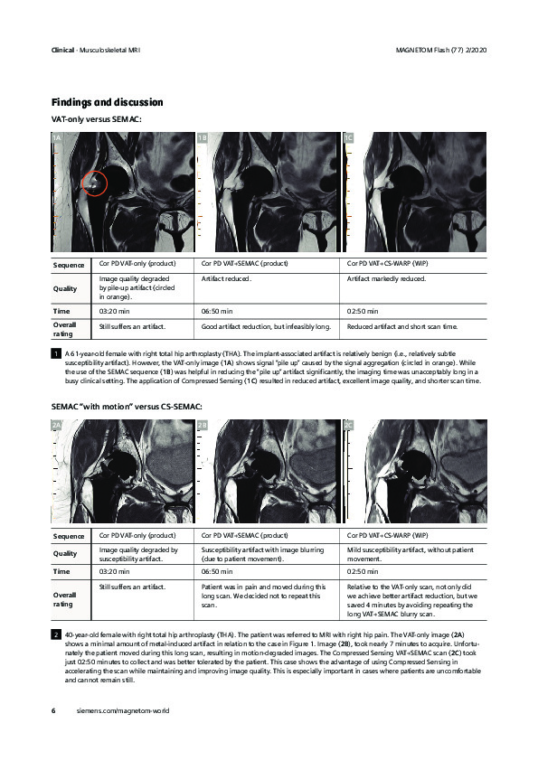 Download Compressed sensing in metal hip imaging: our experience.