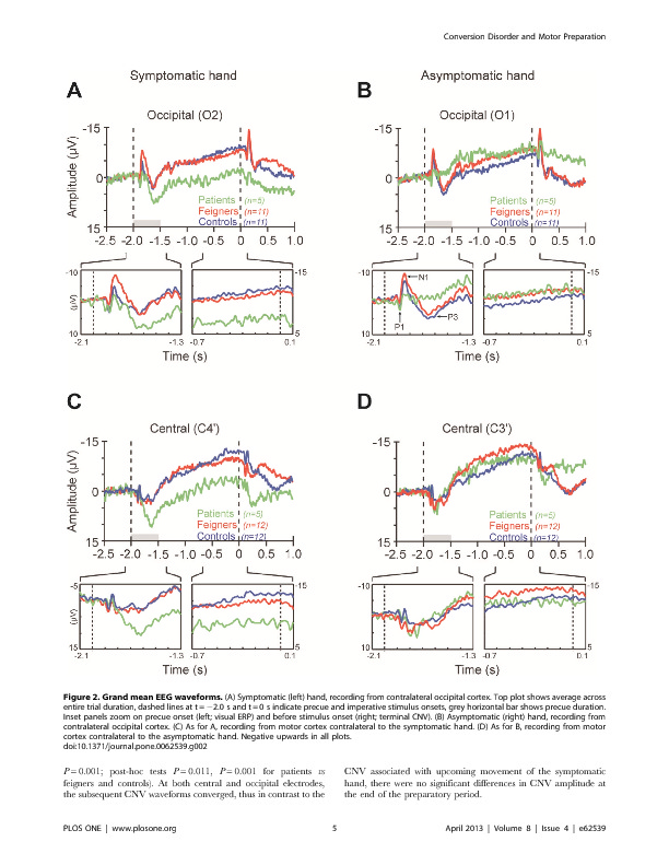 Download Distinct Modulation of Event-Related Potentials during Motor Preparation in Patients with Motor Conversion Disorder