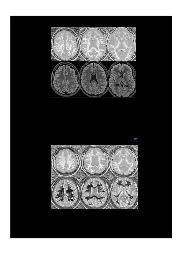 Download Ultra-High Contrast MRI: Using Divided Subtracted Inversion Recovery (dSIR) and Divided Echo Subtraction (dES) Sequences to Study the Brain and Musculoskeletal System.