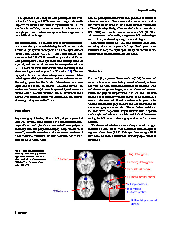 Download Cerebral perfusion is not impaired in persons with moderate obstructive sleep apnoea when awake.