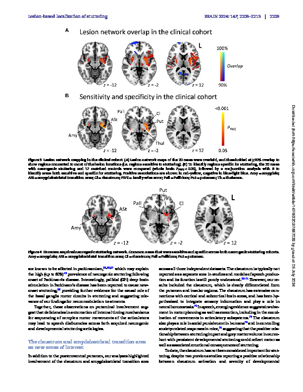 Download Localization of stuttering based on causal brain lesions.