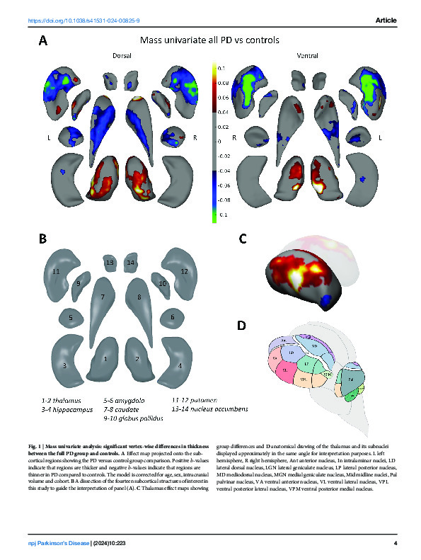 Download A worldwide study of subcortical shape as a marker for clinical staging in Parkinson’s disease.