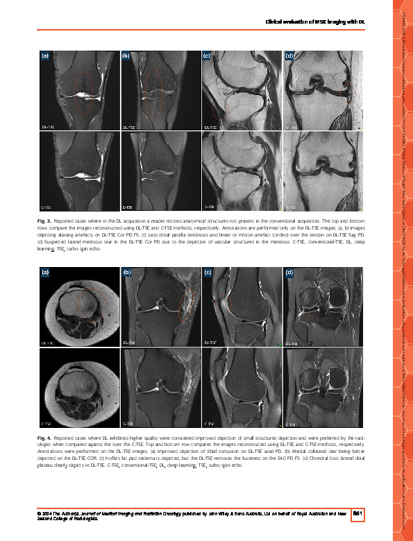 Download Evaluation of deep‐learning TSE images in clinical musculoskeletal imaging.